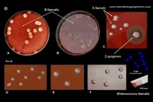 enterococcus